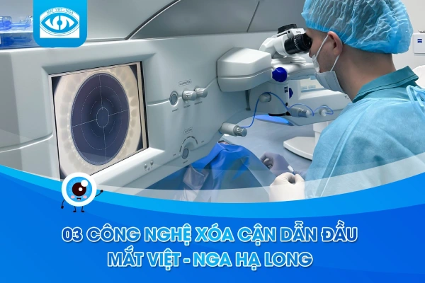 Những công nghệ xóa cận dẫn đầu tại Mắt Việt – Nga Hạ Long