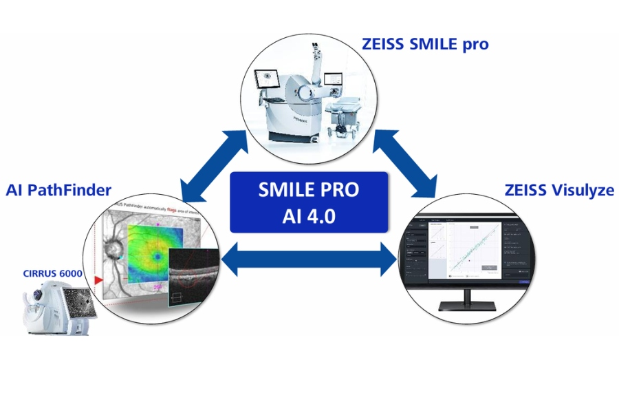 Xóa cận cá nhân hóa với SMILE Pro AI 4.0, nâng cao độ chính xác trong điều trị tật khúc xạ