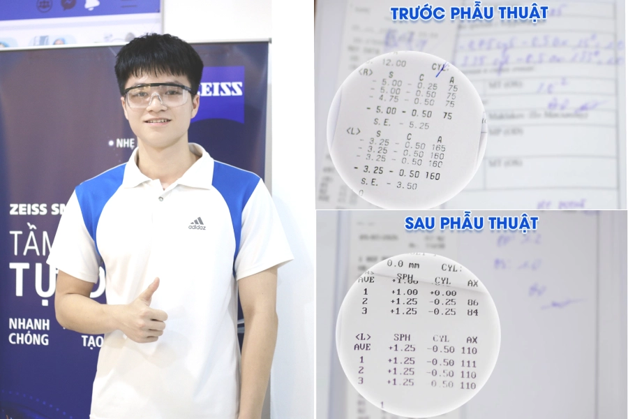 Chia tay kính cận trước ngưỡng cửa đại học, nam sinh 2K8 sở hữu thị lực sắc nét