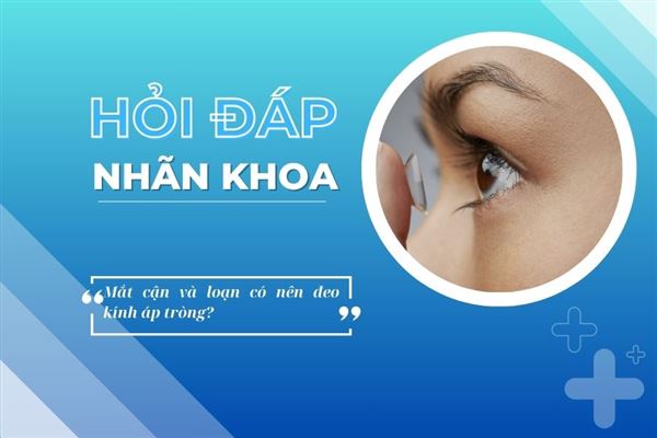 Hỏi đáp nhãn khoa: Mắt cận và loạn có nên đeo kính áp tròng?