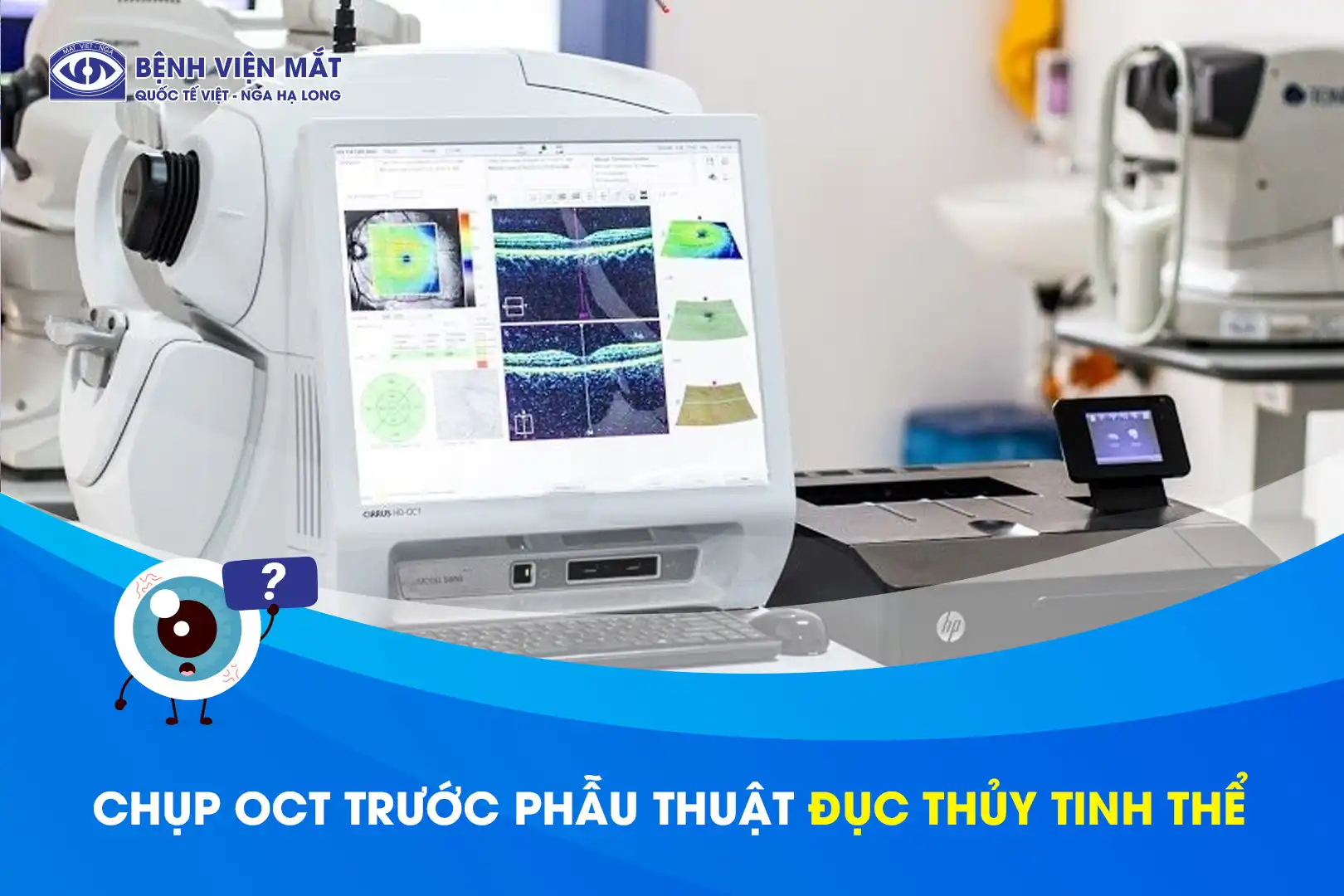 Vì sao cần chụp cắt lớp võng mạc OCT trước phẫu thuật đục thủy tinh thể?