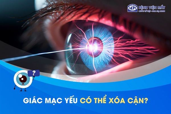 Giác mạc mỏng yếu có thể xóa cận laser được không?