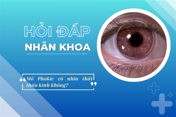 Hỏi đáp nhãn khoa: Mổ Phakic có nhìn thấy thấu kính không?