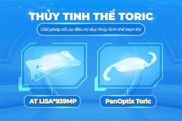 Phân biệt 2 loại thấu kính đa tiêu điều chỉnh loạn thị phổ biến hiện nay