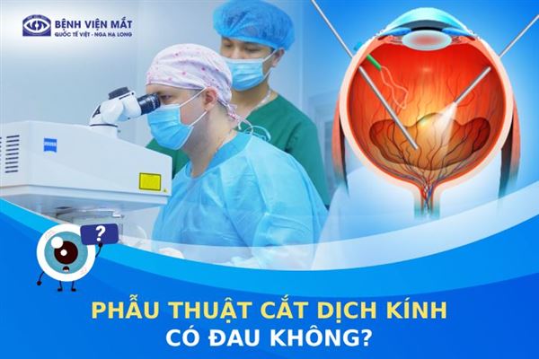 Phẫu thuật cắt dịch kính có đau không?