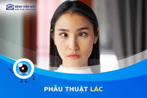 Giải đáp: Khi nào cần phẫu thuật chỉnh lác?