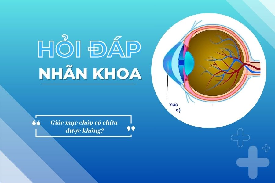 Hỏi đáp nhãn khoa: Giác mạc chóp có chữa được không?