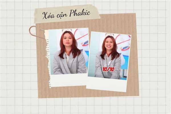 [Review] Cả hai mắt cận loạn 5 diop, 2K Quảng Ninh tìm lại thị lực 10/10 nhờ phương pháp Phakic 